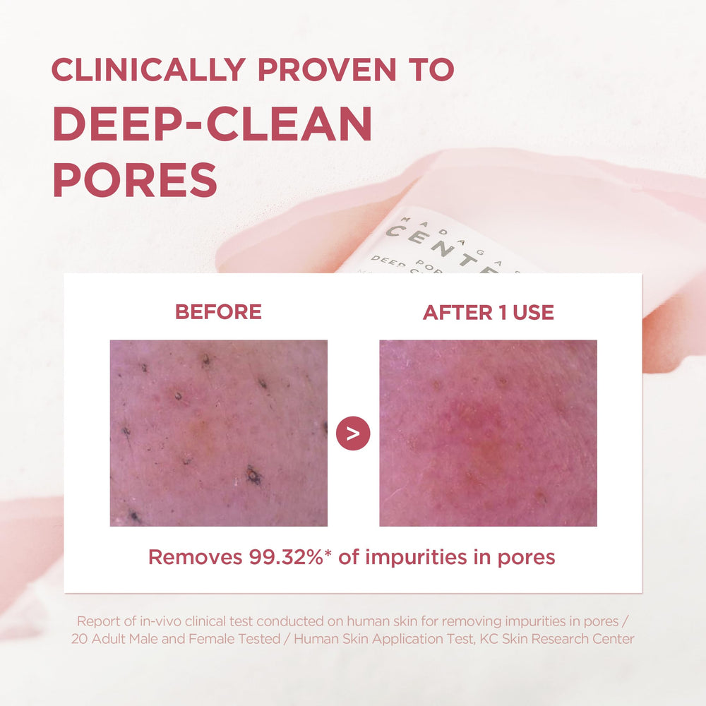 SKIN1004 Poremizing: nettoyage quotidien des pores pour peau fraîche et équilibrée.