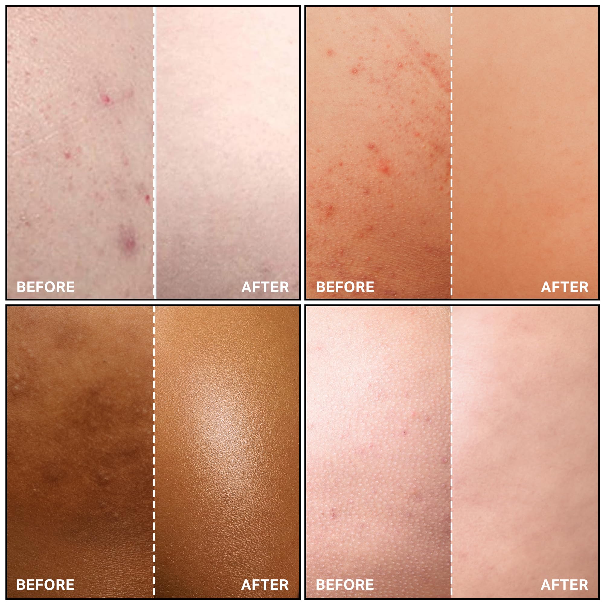 Lotion SKINBOSS Corps ingrédients AHAs calendula pour douceur ciblée.