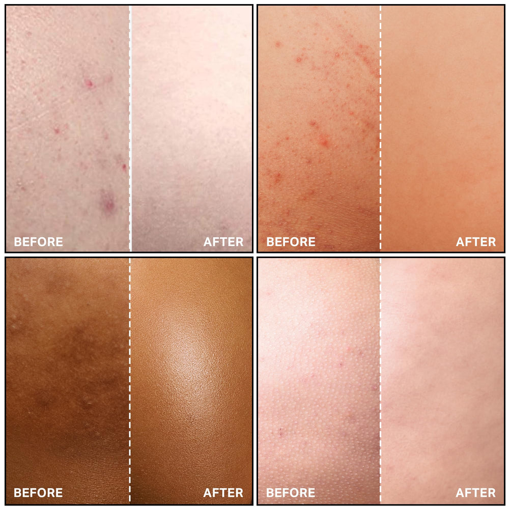 Lotion SKINBOSS Corps ingrédients AHAs calendula pour douceur ciblée.