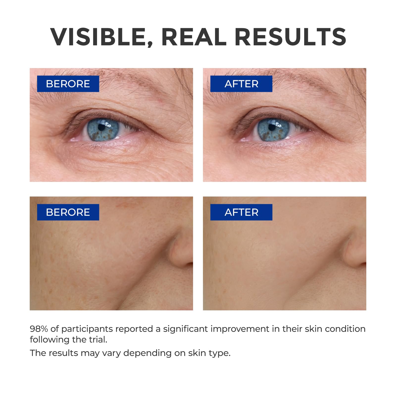 SKINERSE Sérum pentapeptides 5 et vitamine E, soin nocturne éclaircissant le teint.