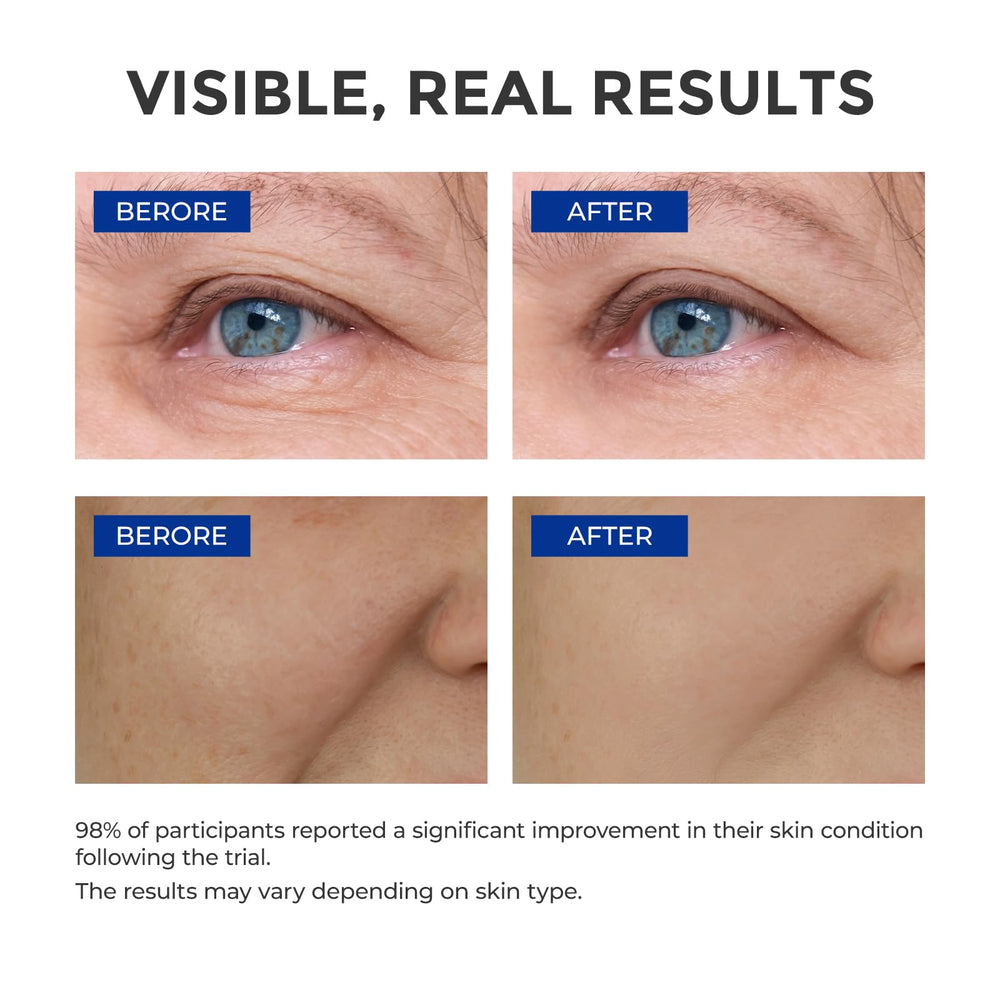 SKINERSE Sérum pentapeptides 5 et vitamine E, soin nocturne éclaircissant le teint.