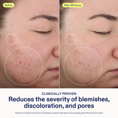 Application du nettoyant Skinfix sur le visage pour une mousse légère.