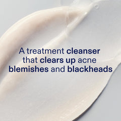 Texture mousse légère Skinfix BHA prête à être appliquée en douceur.