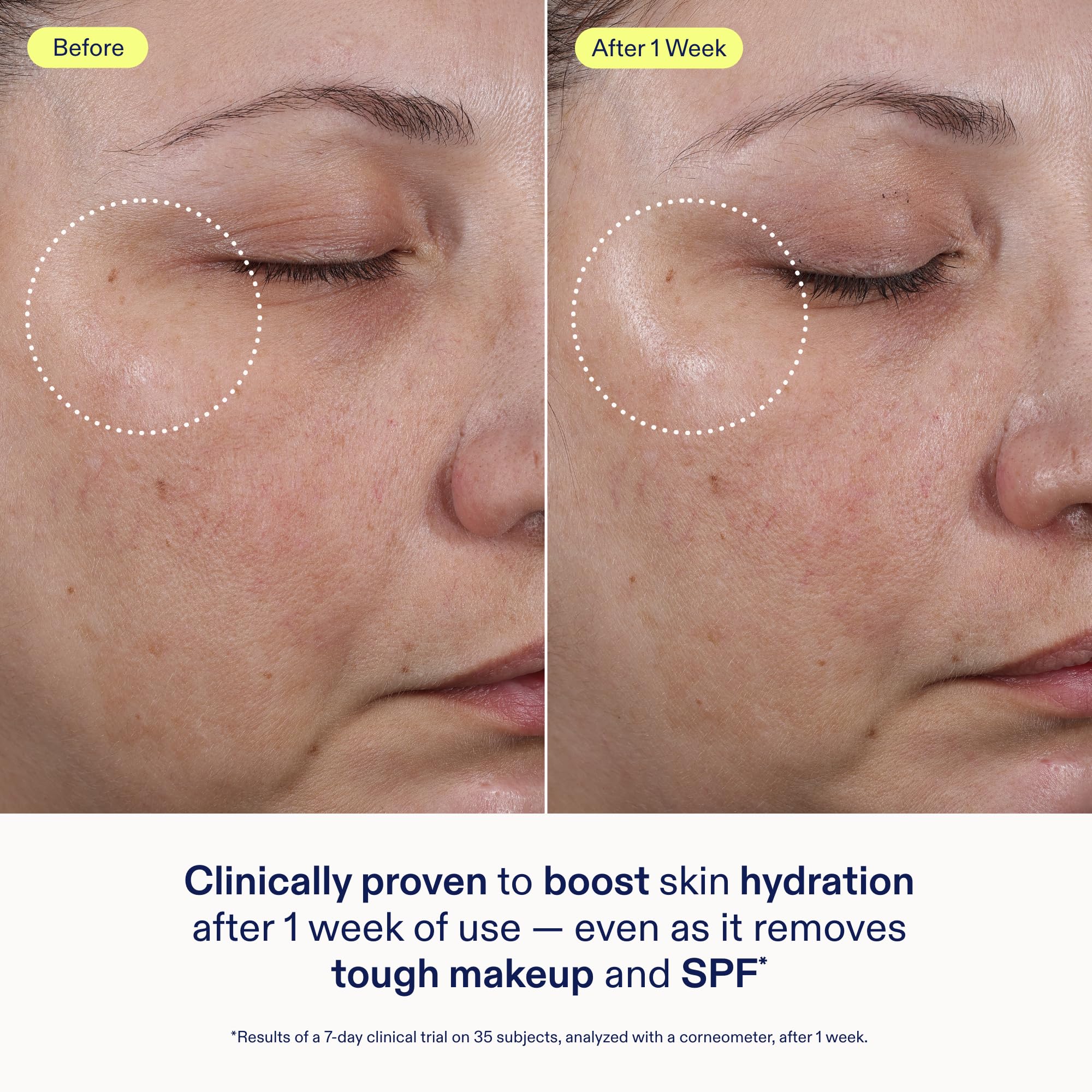Close-up of hydrated skin after cleansing with Skinfix Ceramide + Ectoin