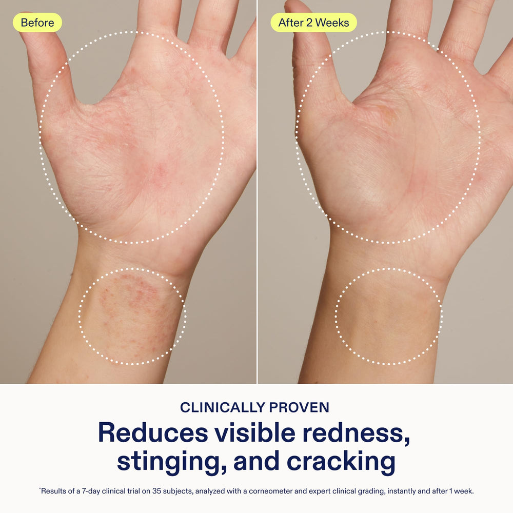 Skinfix Crème Mains Relief - application facile sur les mains pour apaiser