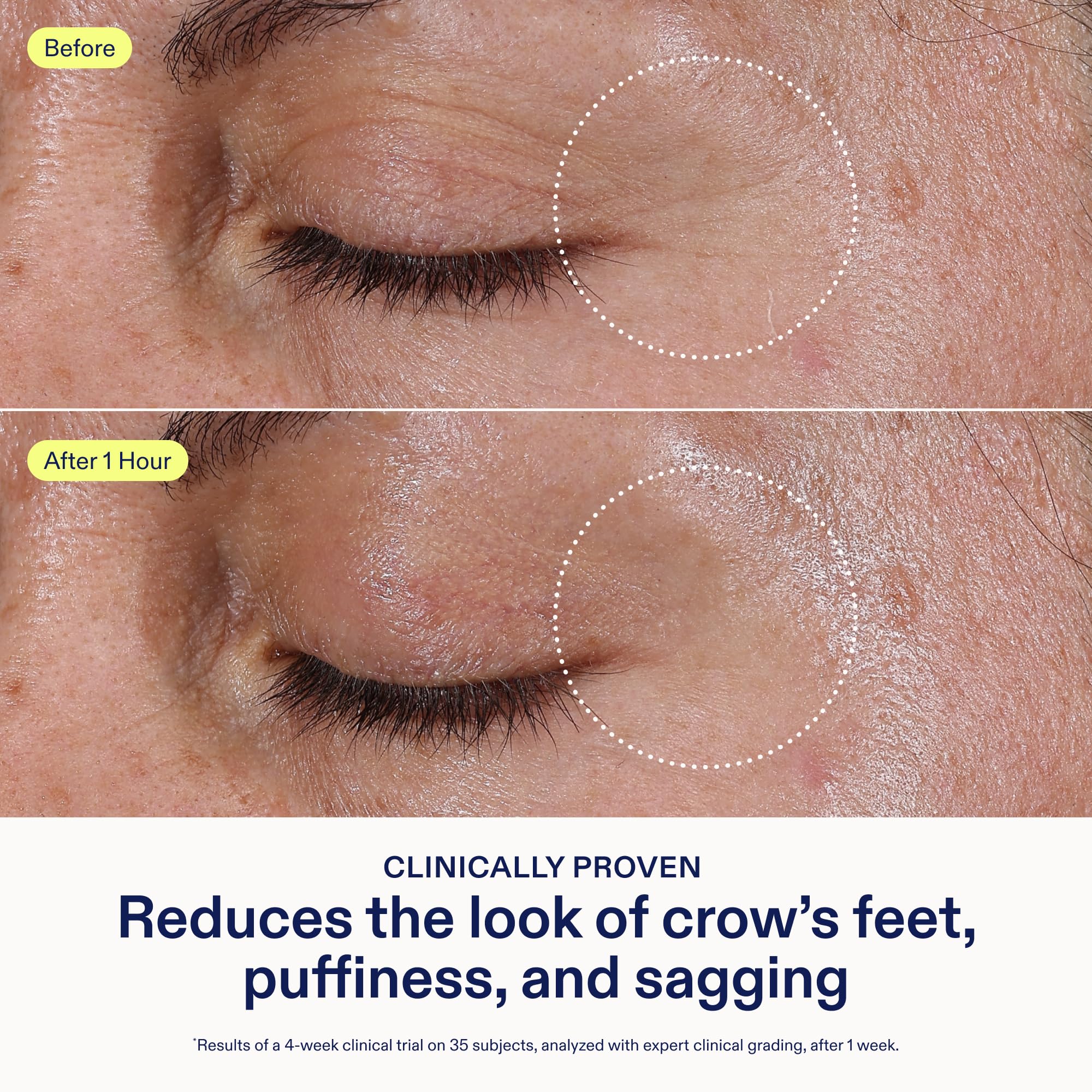 Ingrédients ceramides Skinfix pour hydrater et protéger.