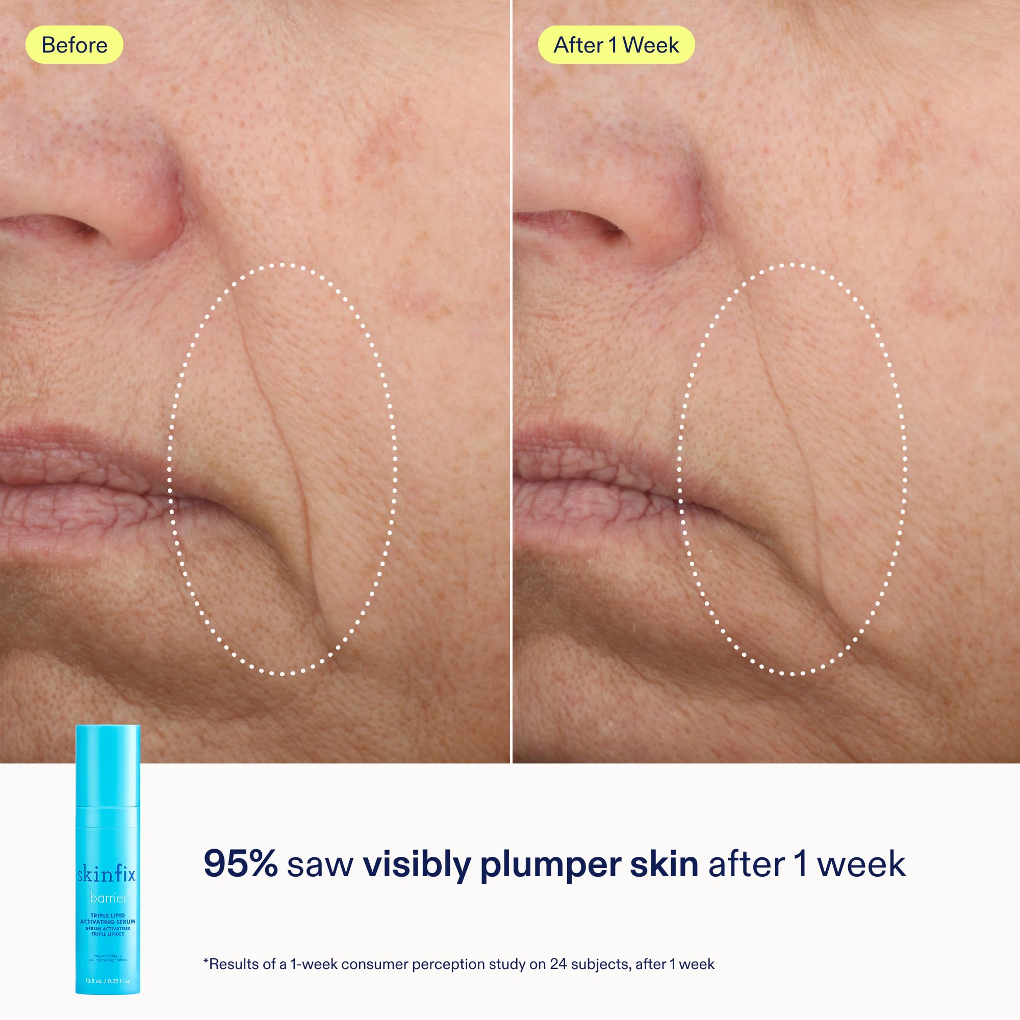 Skinfix mini-kit Barrier+ avec emballage élégant et informatif.