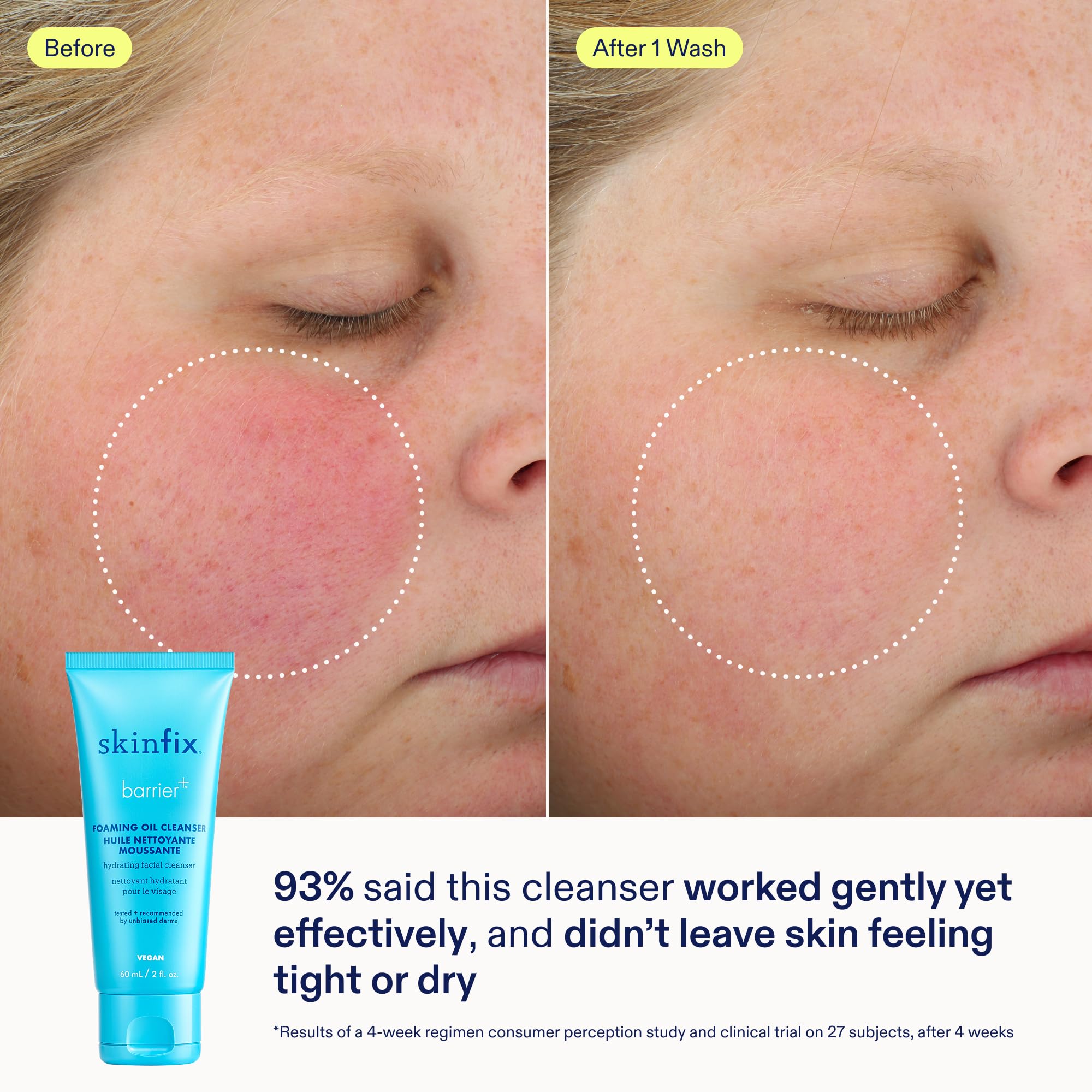 Skinfix mini nettoyant huile mousse, douceur et fraîcheur lors du lavage.