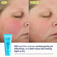 Skinfix mini nettoyant huile mousse, douceur et fraîcheur lors du lavage.