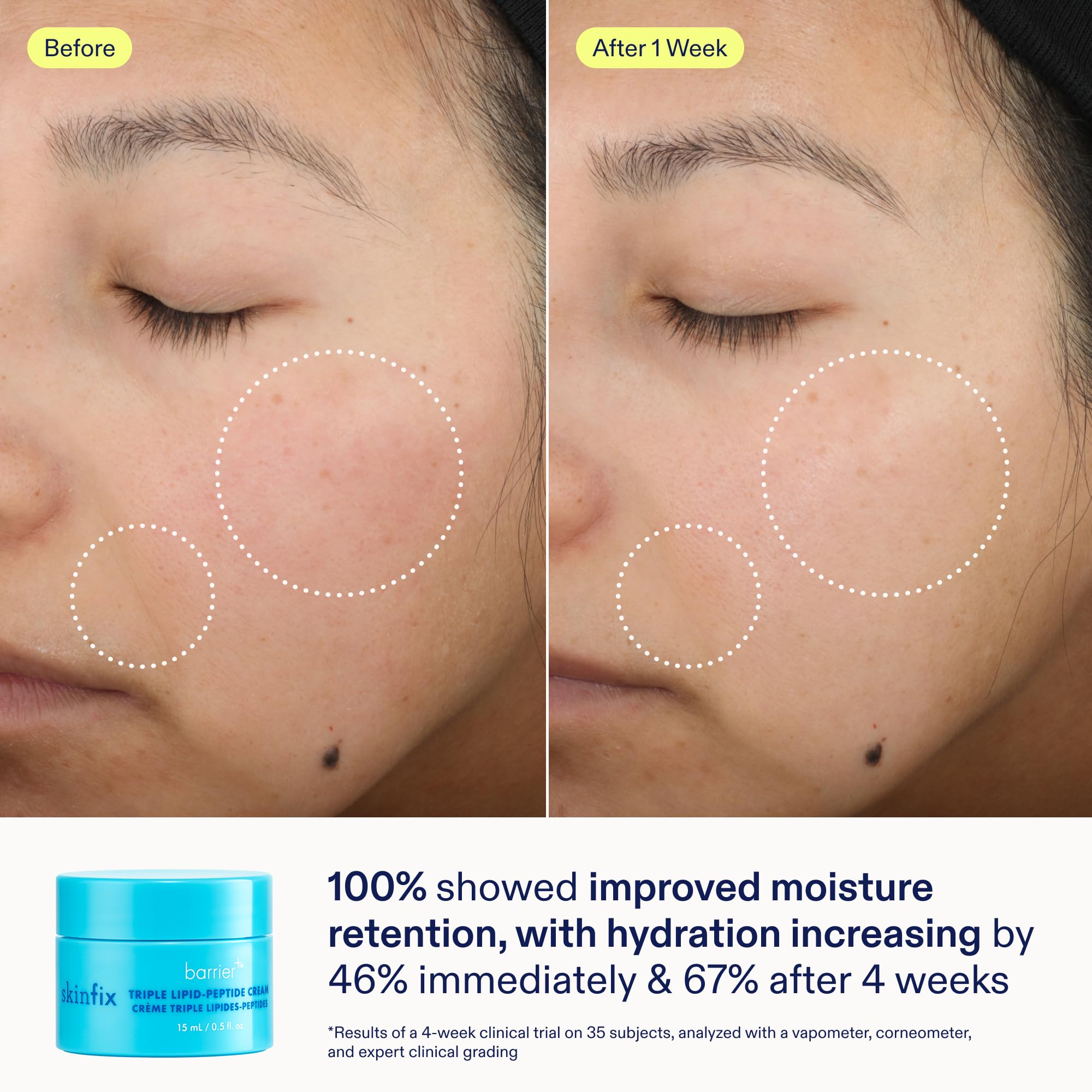 Skinfix hydratation et éclat après utilisation du kit.