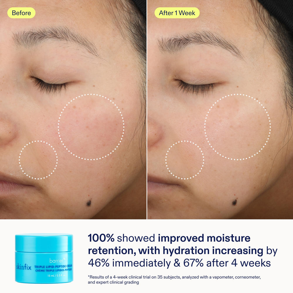 Skinfix hydratation et éclat après utilisation du kit.