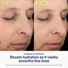 Routine matinale et nocturne avec Skinfix avant la crème hydratante.