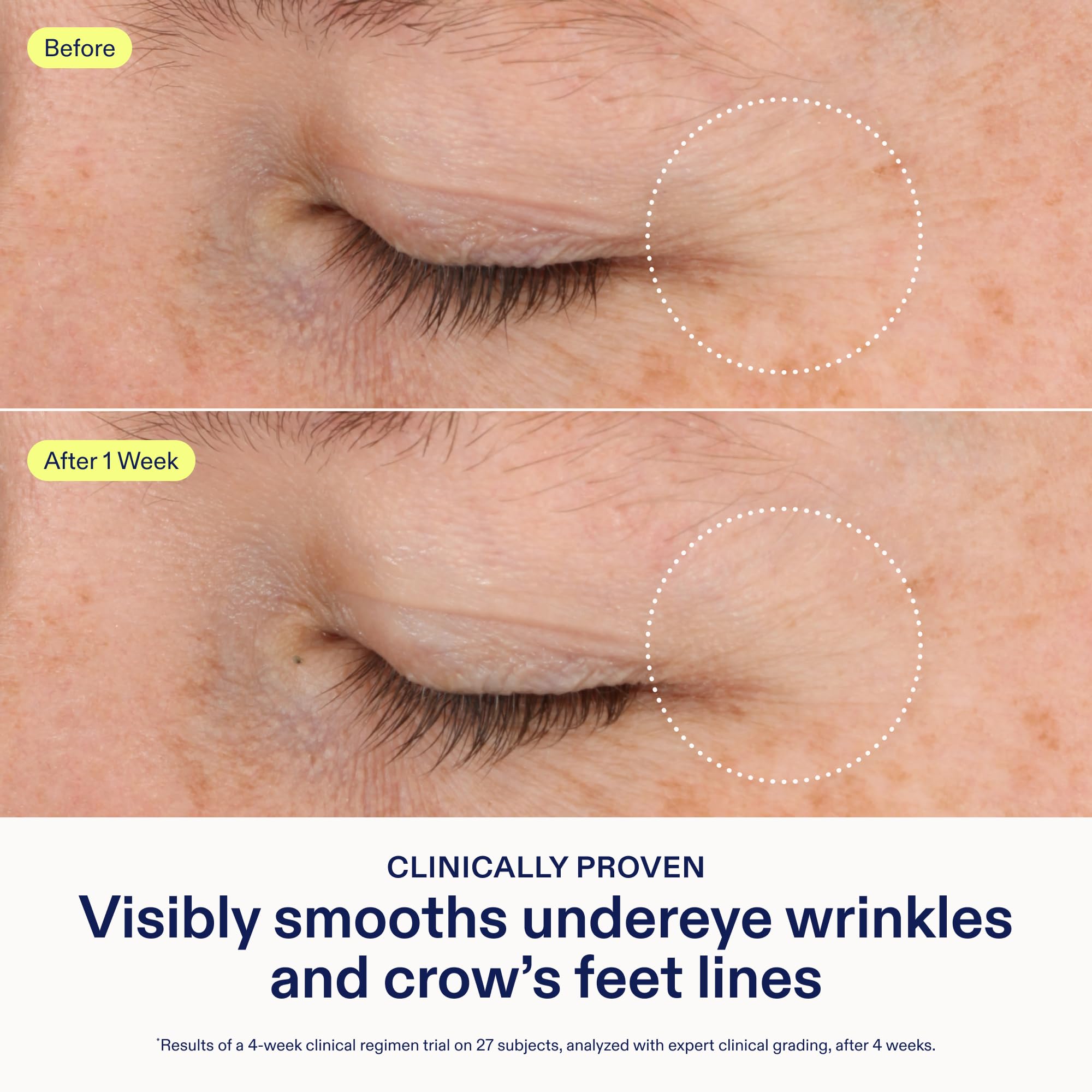 Application douce de Skinfix autour des yeux le matin et le soir.