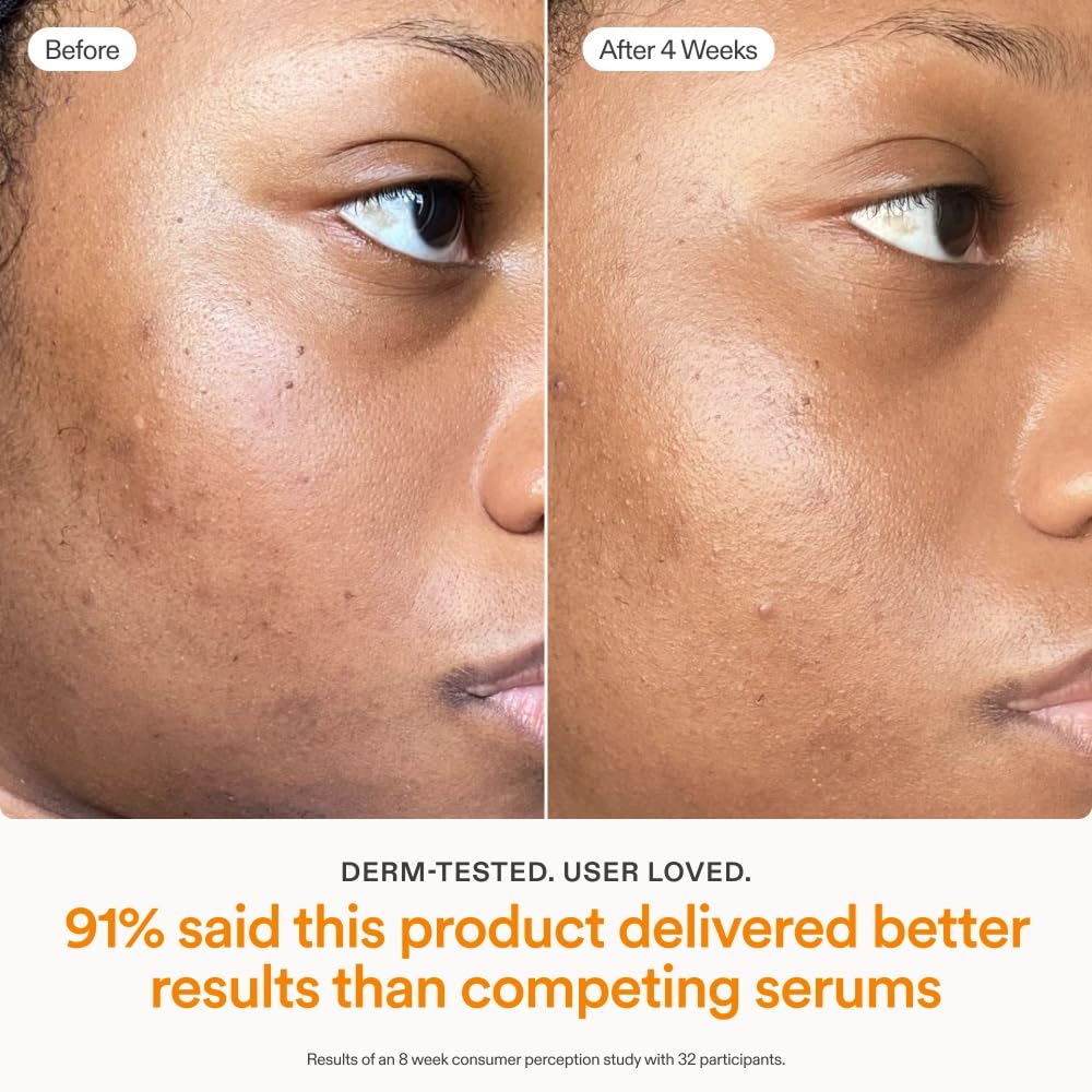 PGA Peptide 2% dans Skinfix Brighten + Firm pour retrouver le rebond.