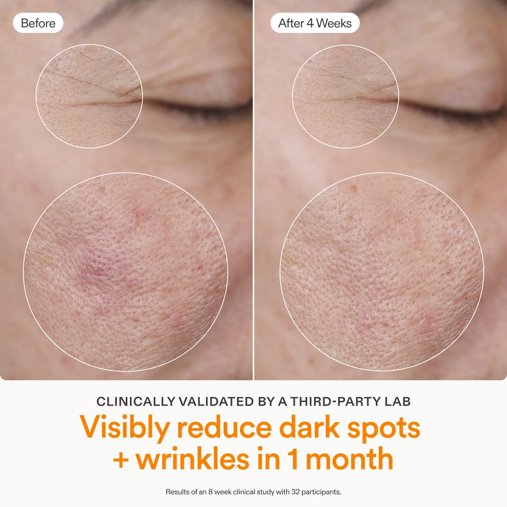 THD Vitamine C 15% dans Skinfix Brighten + Firm, éclat durable.