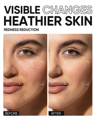 SKINTIFIC Centella apaisante - soin quotidien pour calmer les irritations et hydrater.