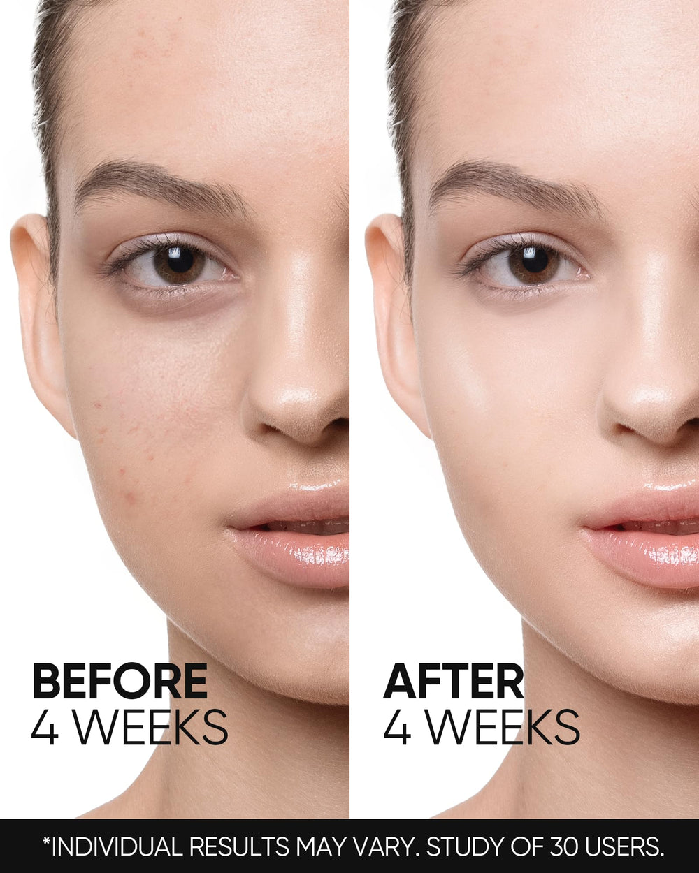 Skintific Pores Minimisés : aperçu des pores visiblement atténués.