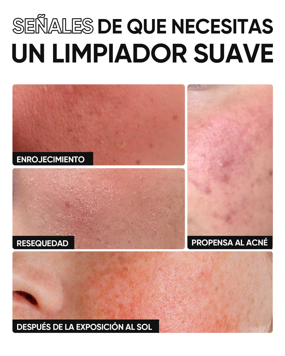 Utilisation quotidienne matin et soir avec SKINTIFIC, soin simple et efficace.