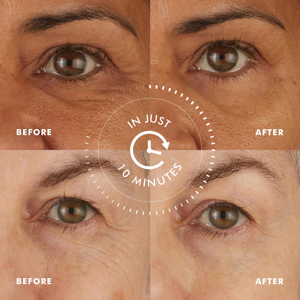 Peptides et coenzyme-q10 dans Skyn Iceland pour raffermir le contour des yeux