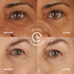 Peptides et coenzyme-q10 dans Skyn Iceland pour raffermir le contour des yeux