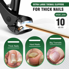 SMZHealing levier-ongles pour soulever cuticules avec précision