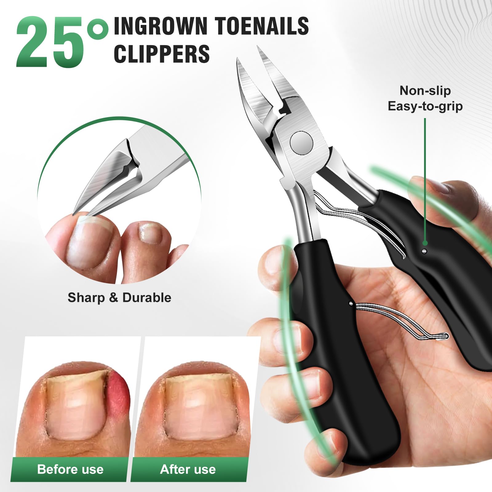 SMZHealing lime-ongles incarnés pour lisser les bords
