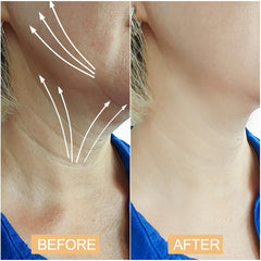 Snifflink lissage ridules: plis du cou visuellement atténués.