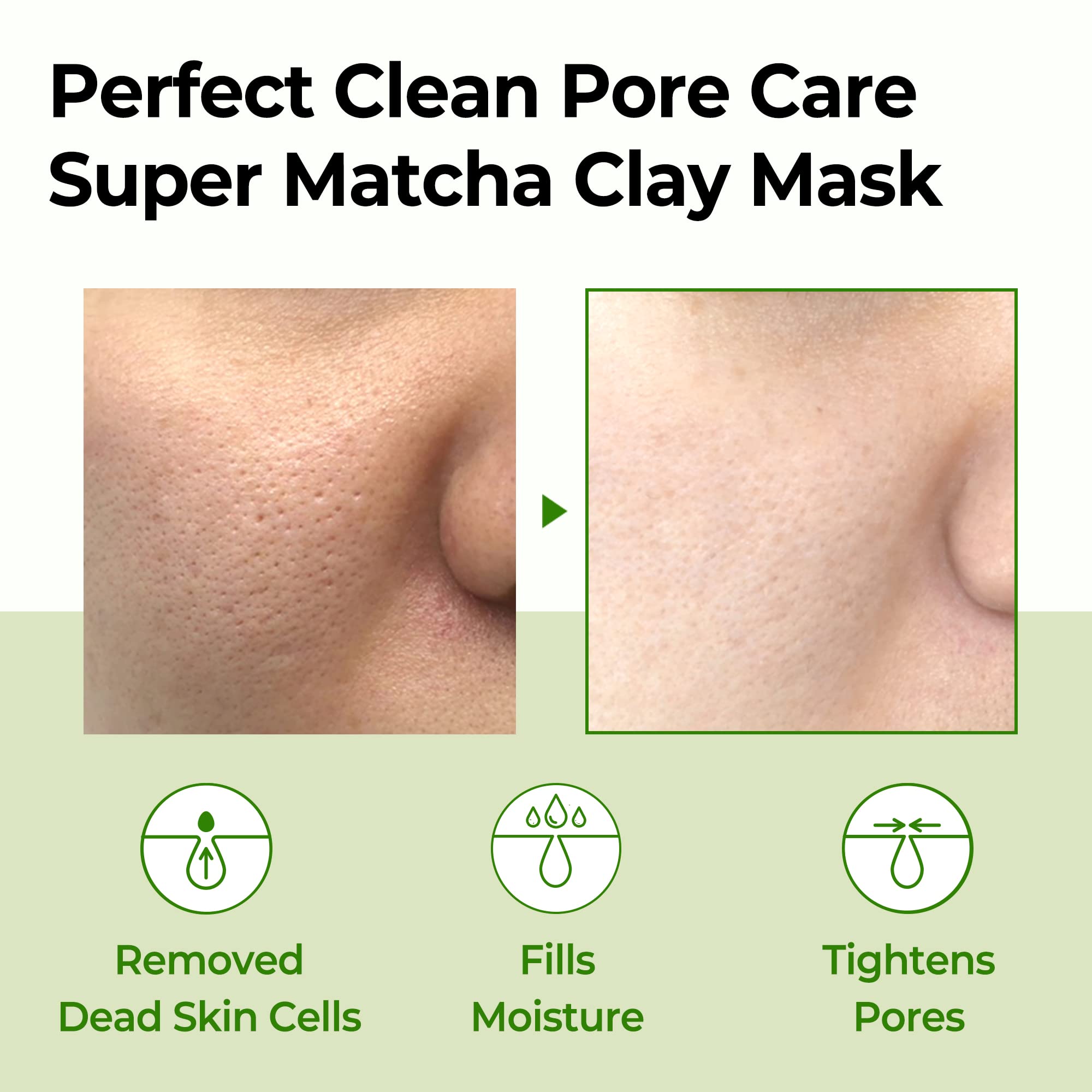 SOME BY MI exfoliant BHA doux pour pores nets