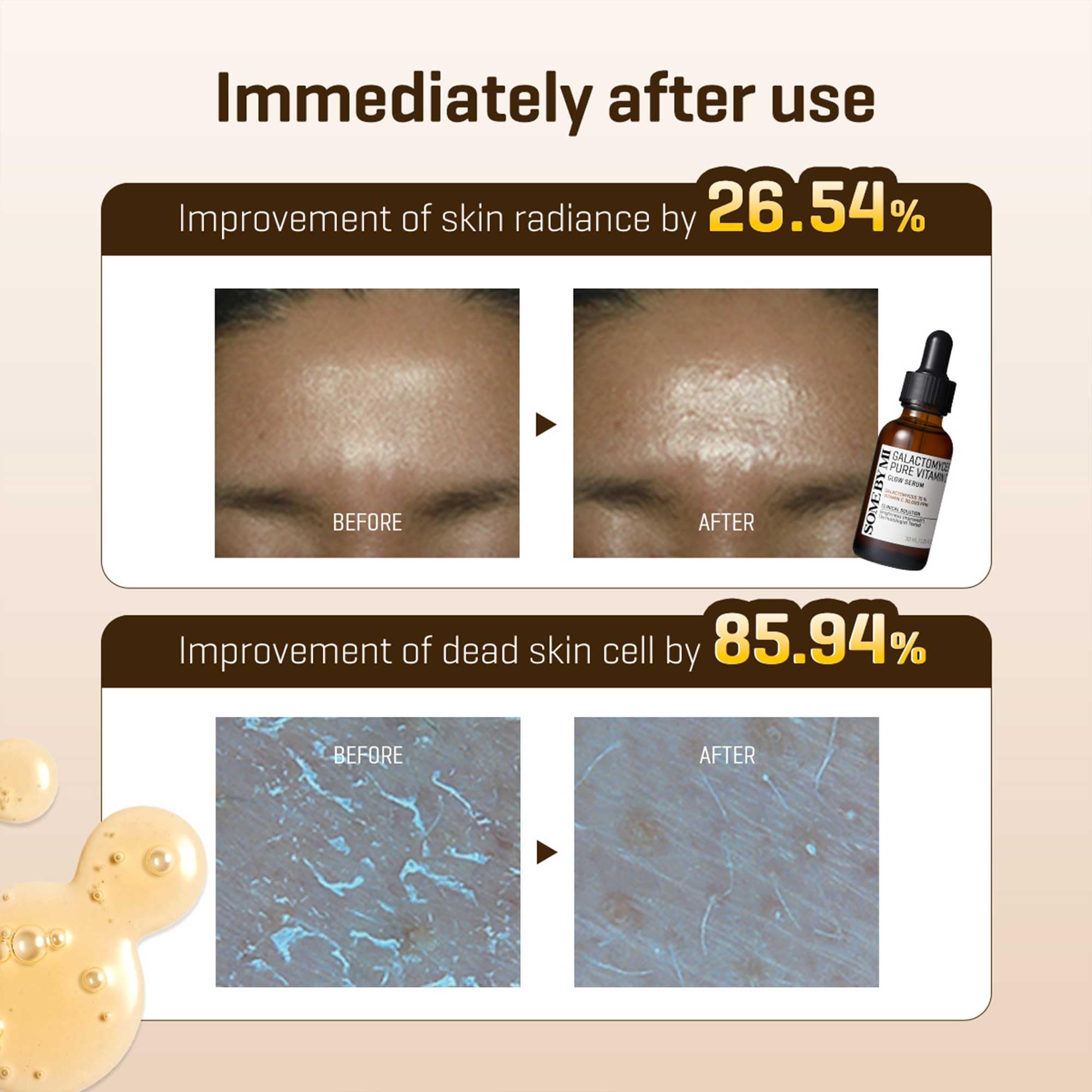 SOME BY MI Galactomyces Vitamine C Pur — amélioration de l’élasticité