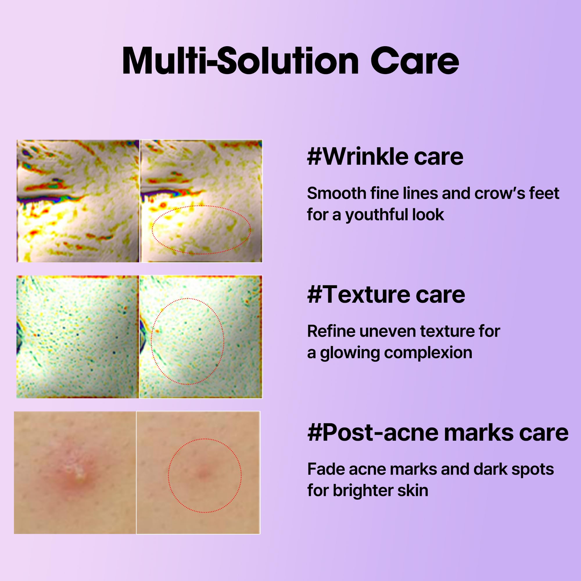 SOME BY MI Retinol Intense Reactivating Serum — étiquette soignée, promesse de résultats visibles éventuels.
