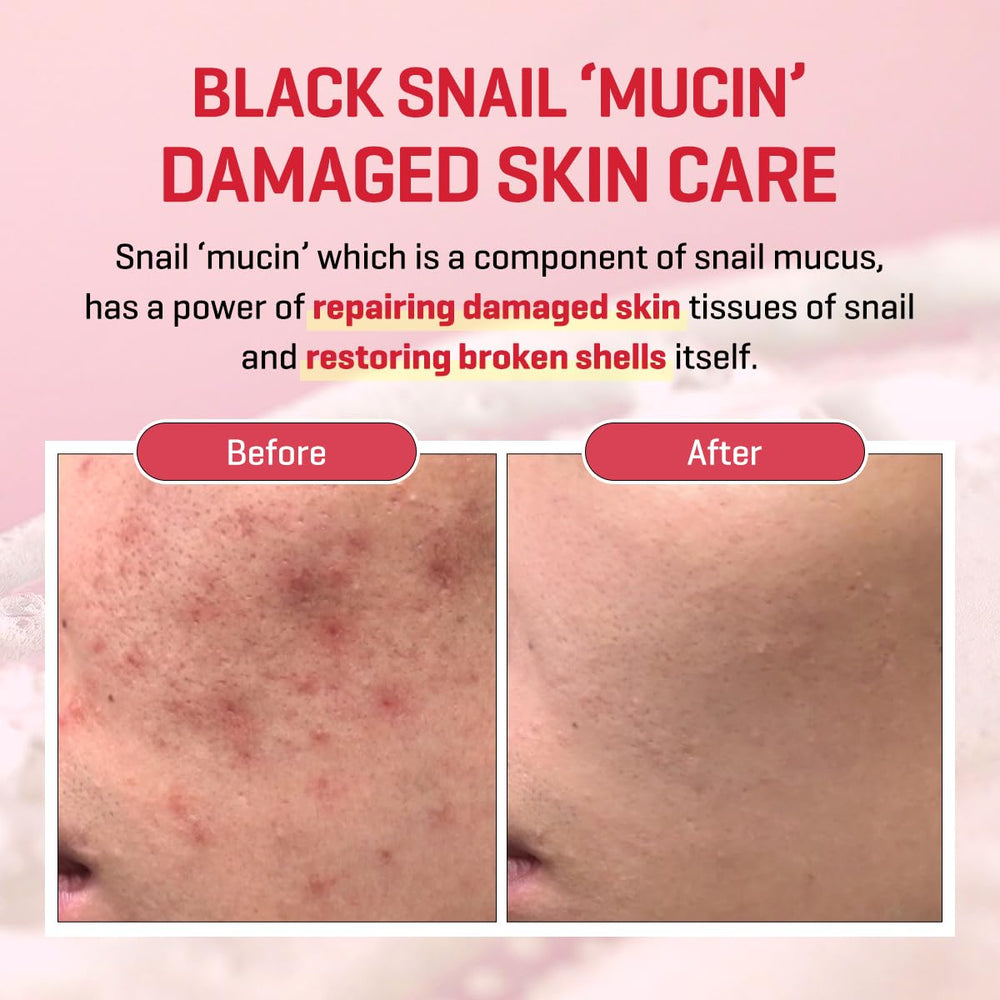 SOME BY MI Snail Truecica Crème pot: format pratique pour une routine