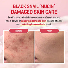 SOME BY MI Snail Truecica Crème pot: format pratique pour une routine