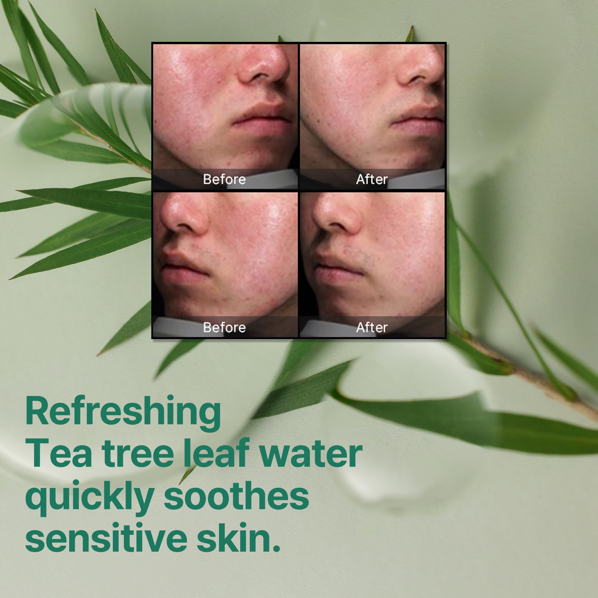 SOME BY MI crème miracle exfoliation AHA BHA PHA — action douce sur les pores