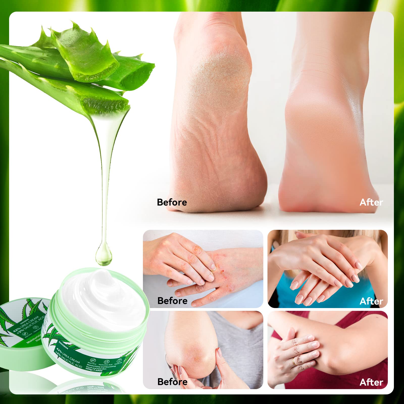 Sonobom Crème à l’urée 42% – ciblage talons et coudes secs