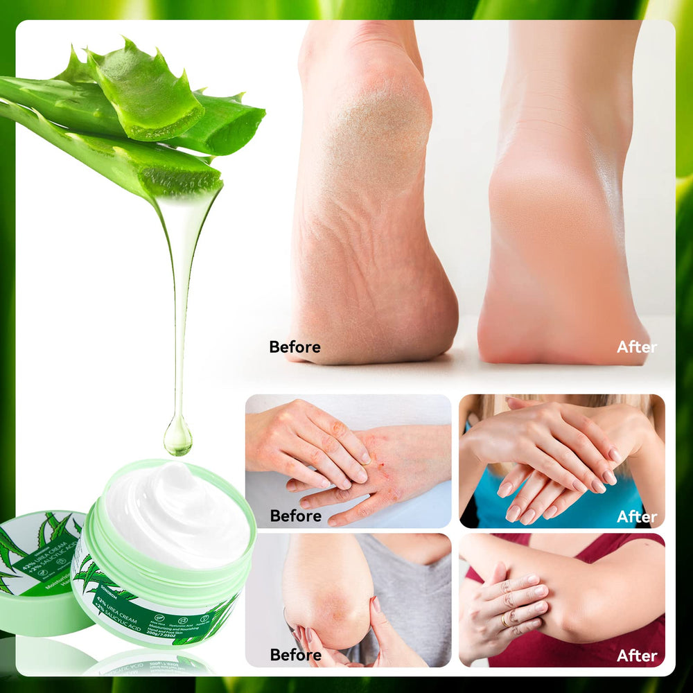Sonobom Crème à l’urée 42% – ciblage talons et coudes secs