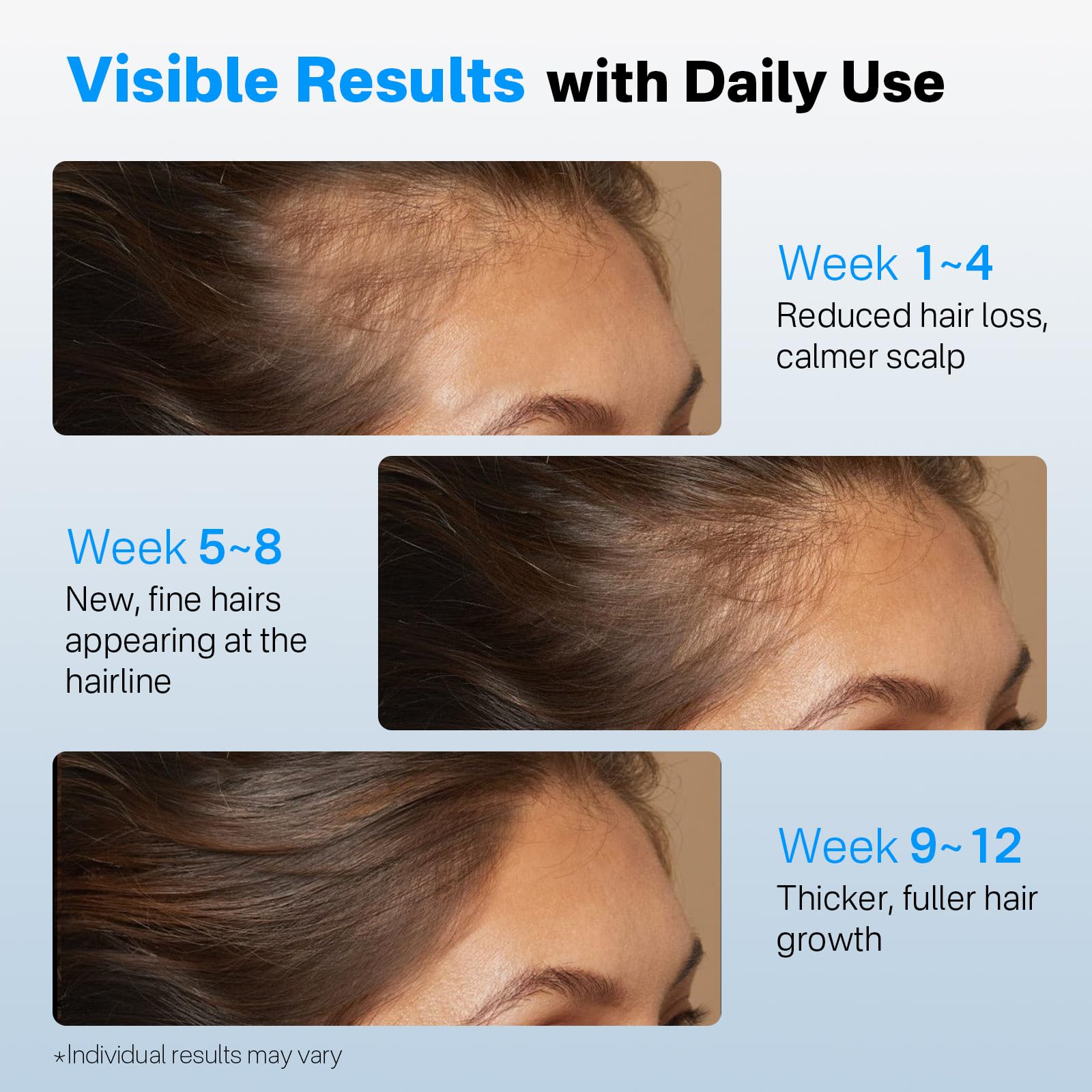 Sornbeo densité cheveux cuir chevelu grâce à une utilisation régulière.
