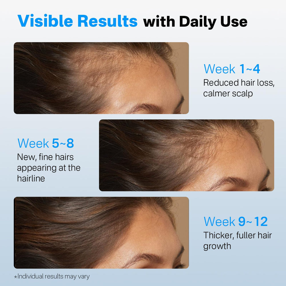 Sornbeo densité cheveux cuir chevelu grâce à une utilisation régulière.