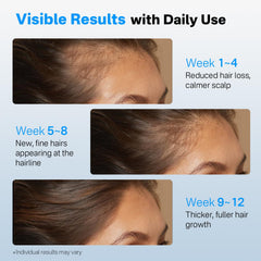 Sornbeo densité cheveux cuir chevelu grâce à une utilisation régulière.