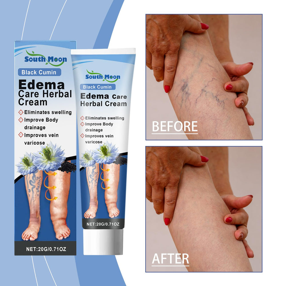 South Moon Crème relief jambes varices – améliore la circulation et réduit la lourdeur