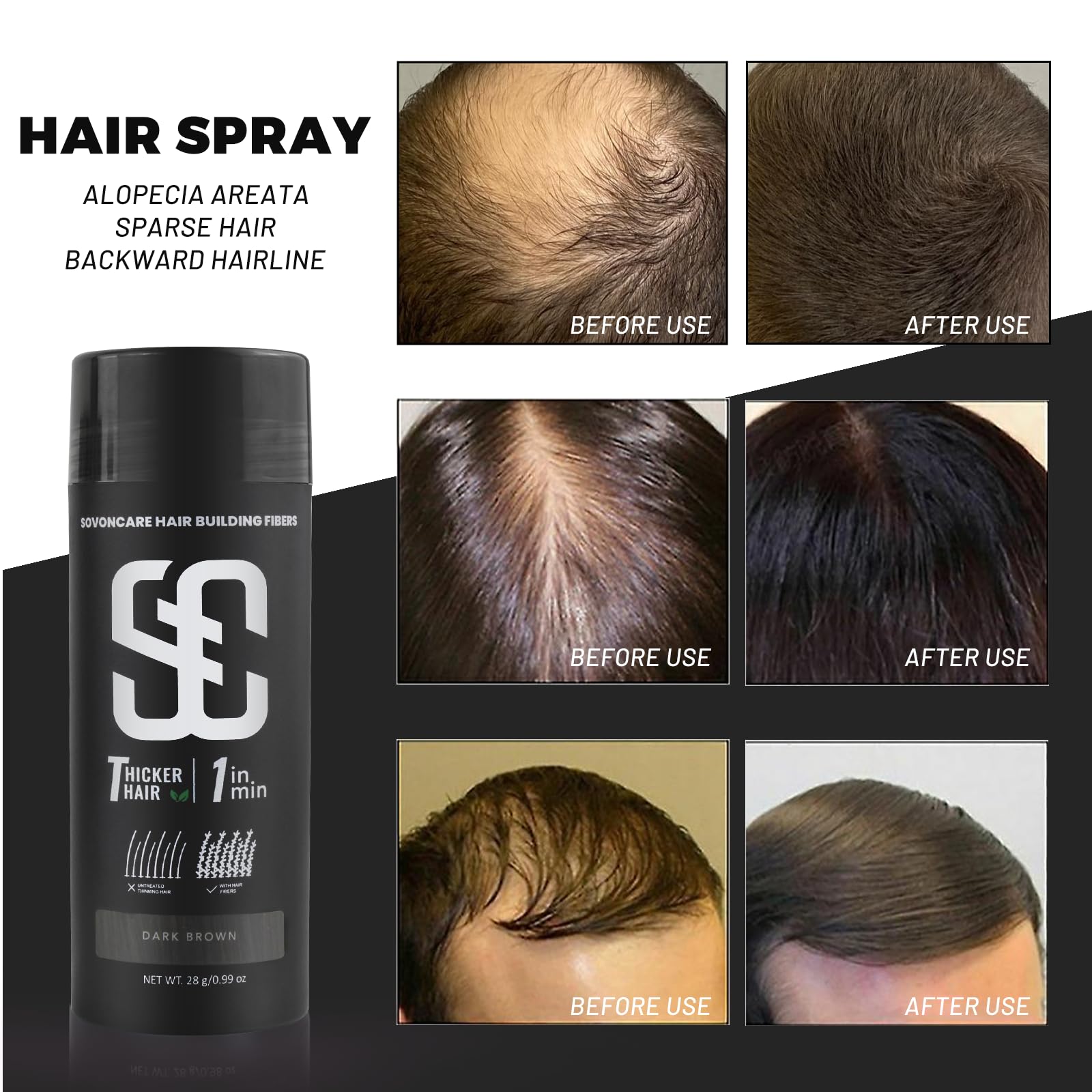 SOVONCARE fibres-cheveux zone-appliquée: camoufle les zones clairsemées pour un rendu homogène.