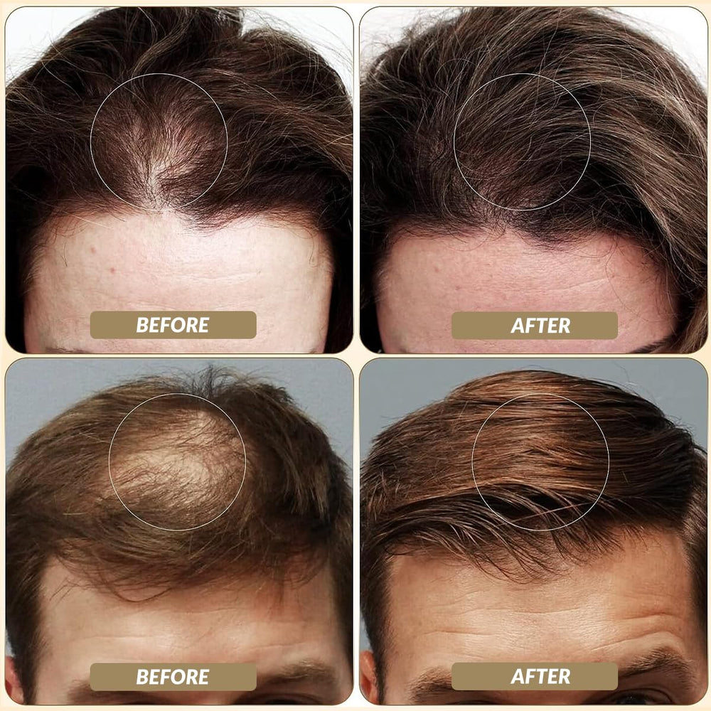 SOVONCARE fibres-cheveux-épaisseur: donne l'impression de cheveux plus épais et volumineux.