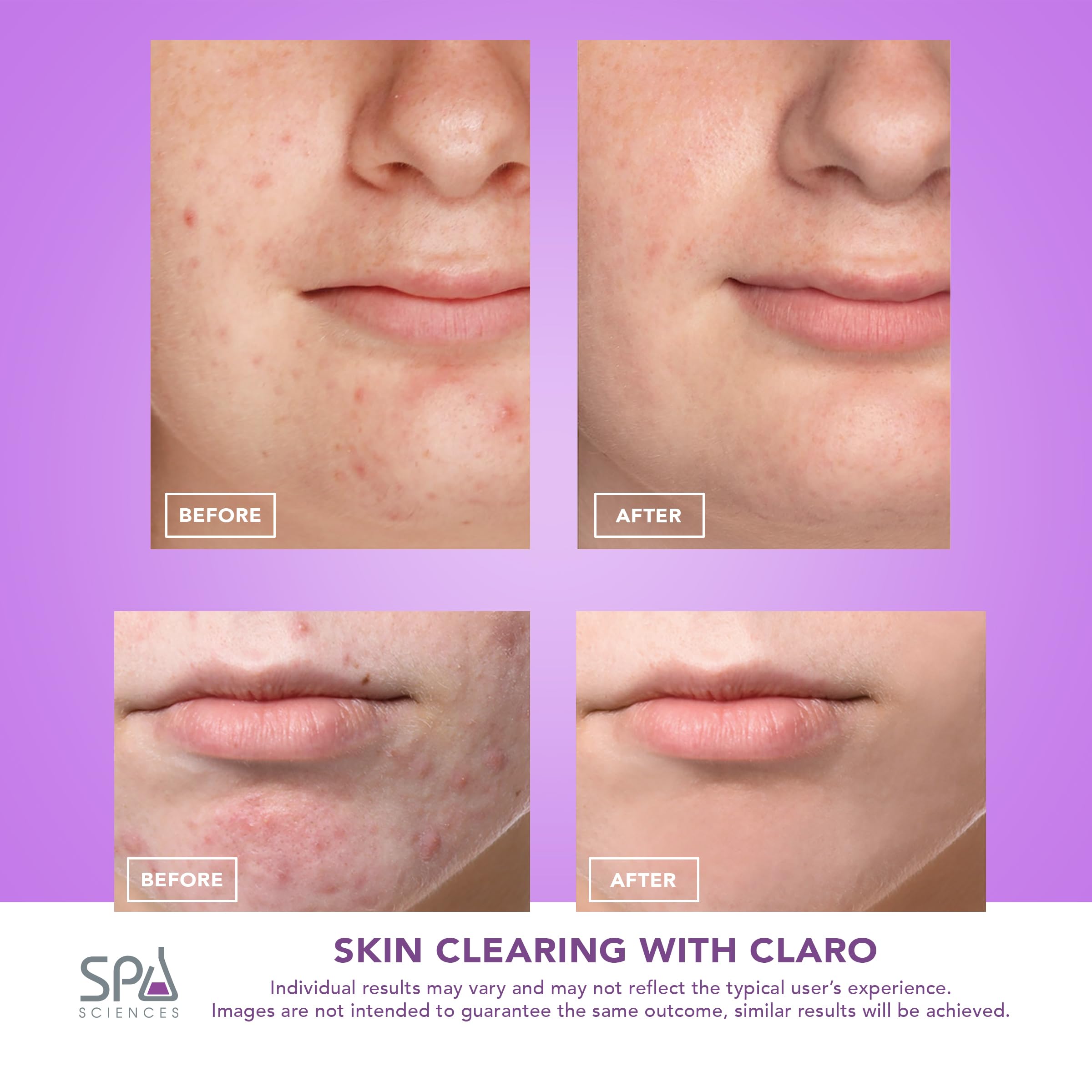 Spa Sciences CLARO – emballage et étiquettes clairs pour une installation simple.