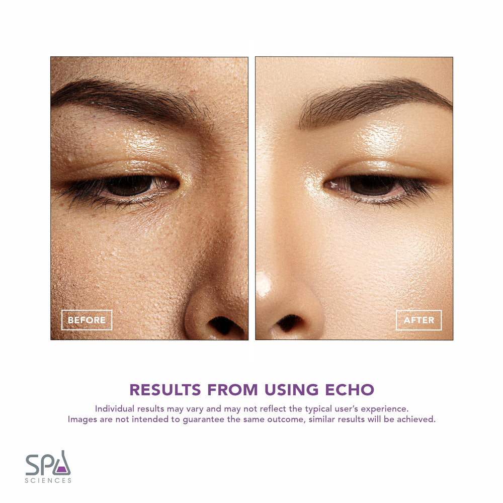 Spa Sciences ECHO – Trois vitesses ajustables pour personnaliser l’application.