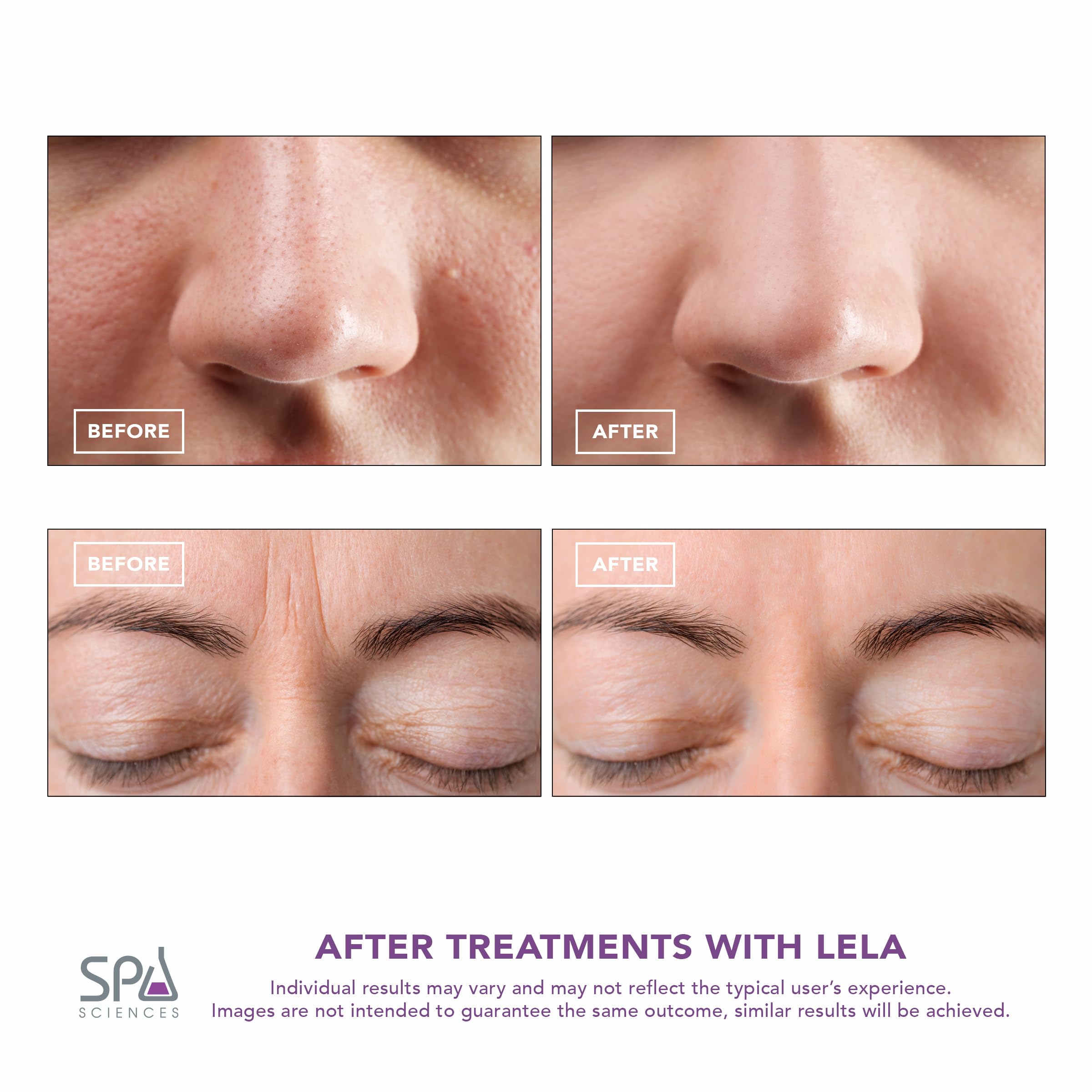 Spa Sciences LELA infusion de sérum—pénétration améliorée des soins.