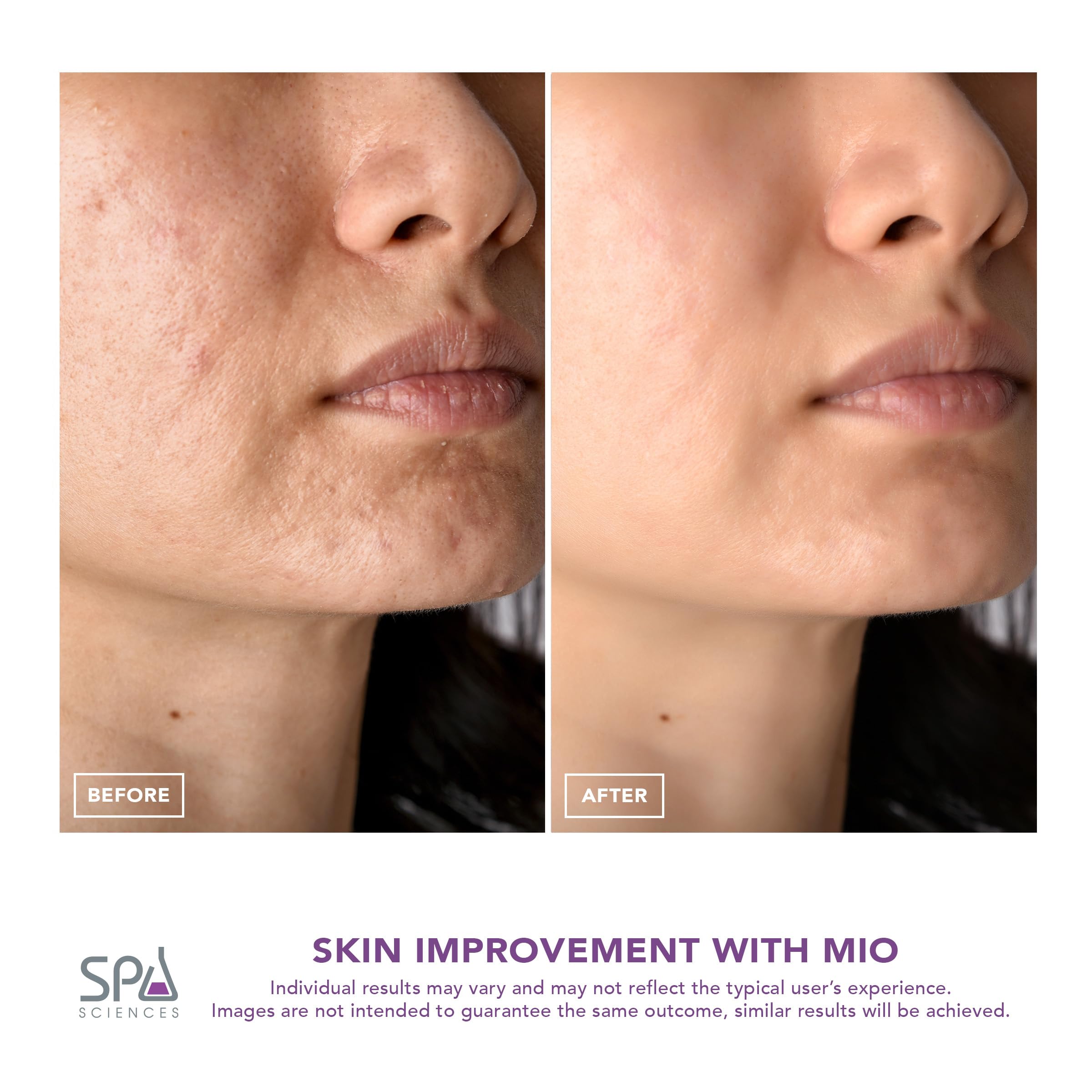 Spa Sciences MIO technologie de resurfacage pour peau plus lisse.