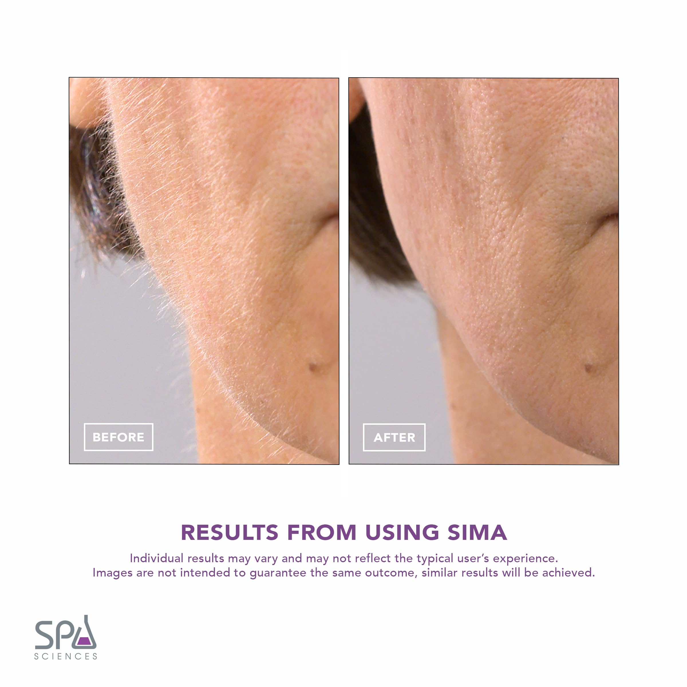 SIMA Spa Sciences, utilisation USB rechargeable à domicile pour routine rapide