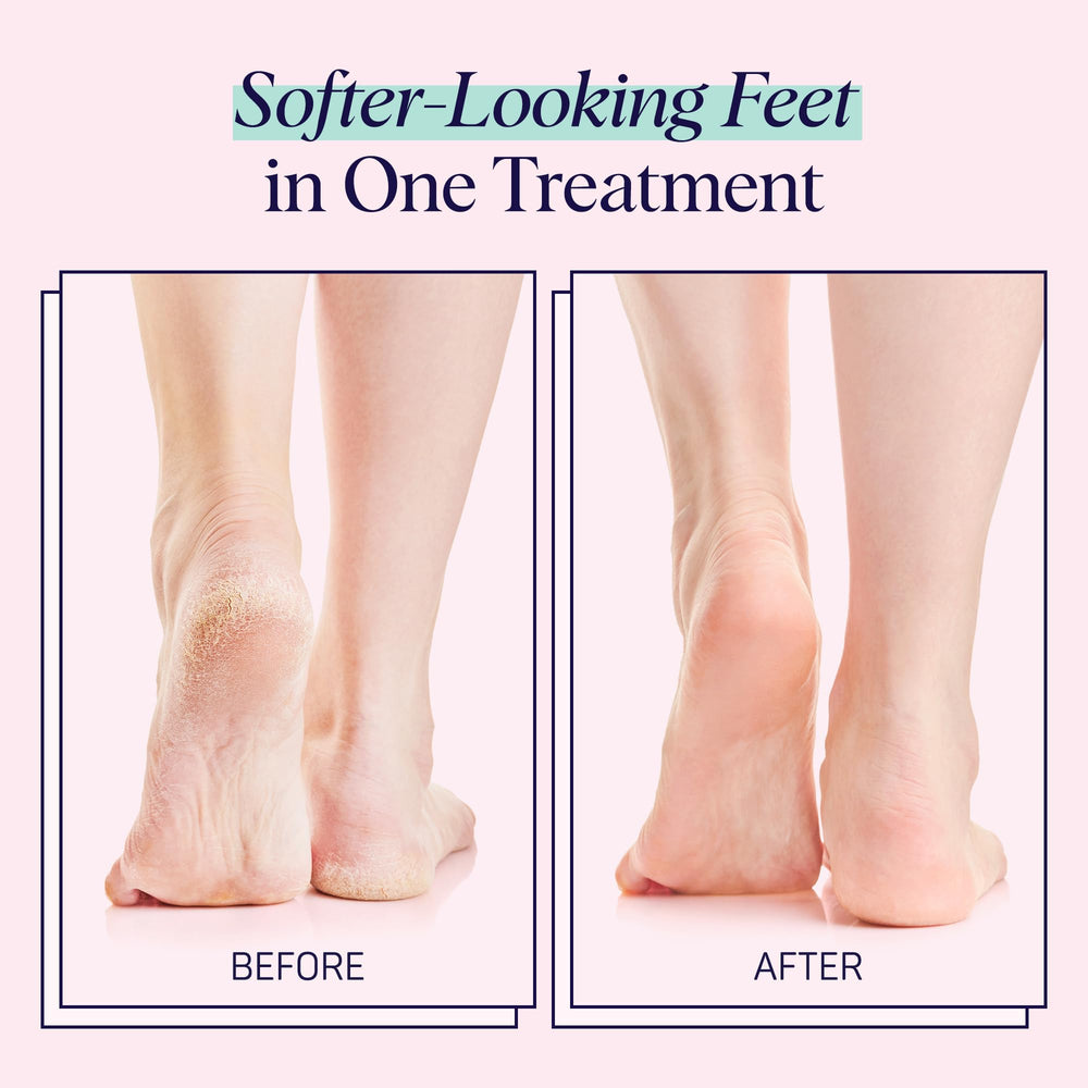 SpaLife Moisturizing Foot Sockies cream texture absorbing into dry skin