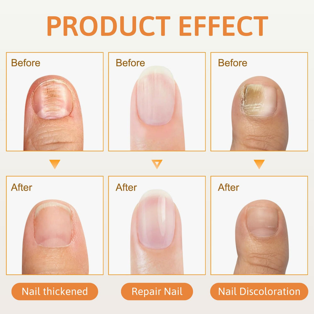 Spray Venin d'Abeille – brillance et solidité des ongles