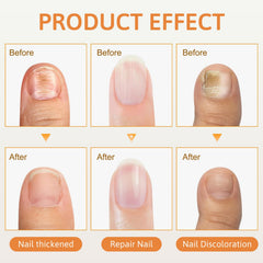 Spray Venin d'Abeille – brillance et solidité des ongles
