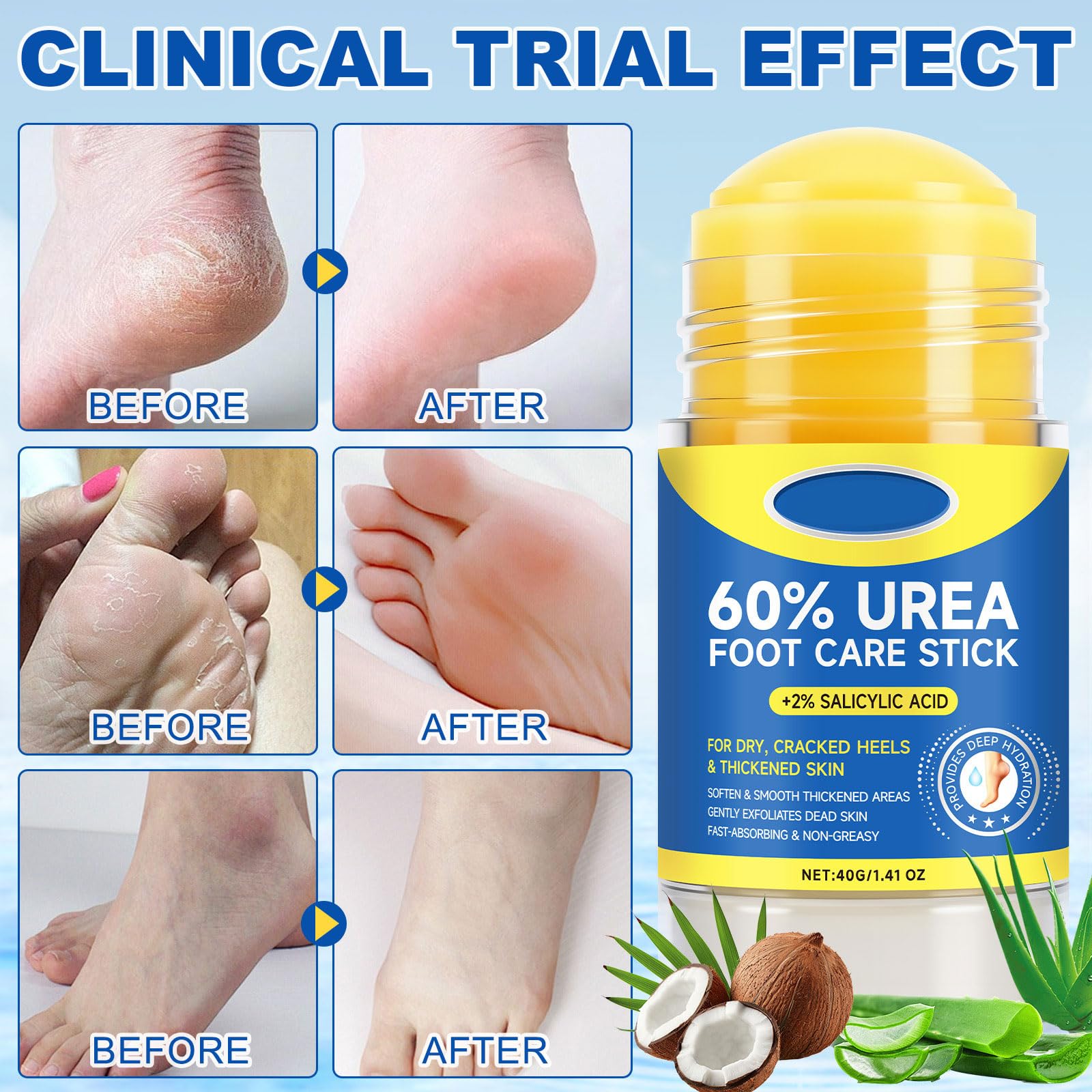 SPRINGSUGAR Stick aplication rapide, absorption non grasse sur les pieds.